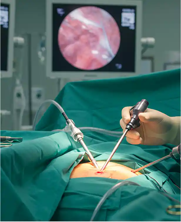 Chirurgie digestive de pointe