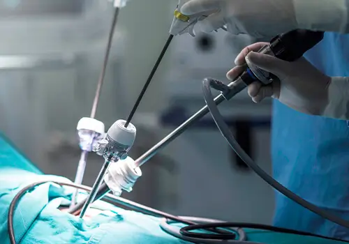 Chirurgie classique, ambulatoire et mini invasive